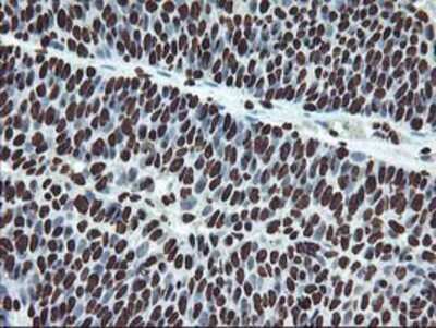 Immunohistochemistry-Paraffin: OSGEP Antibody (OTI9E3) [NBP2-00823]