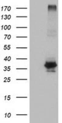 Western Blot: OSGEP Antibody (OTI9E3) [NBP2-00823]