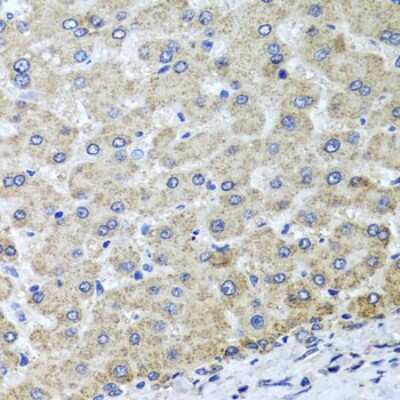 Immunohistochemistry-Paraffin: OSGEPL1 Antibody - BSA Free [NBP2-93751]