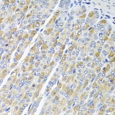 Immunohistochemistry-Paraffin: OSGEPL1 Antibody - BSA Free [NBP2-93751]