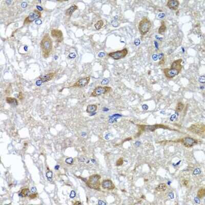 Immunohistochemistry-Paraffin: OSGEPL1 Antibody - BSA Free [NBP2-93751]