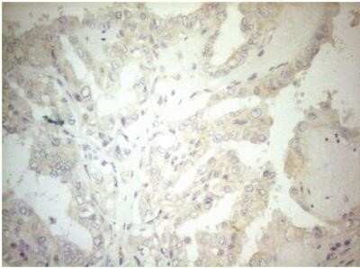 Immunohistochemistry: OSGIN2 Antibody (OTI7D12) - Azide and BSA Free [NBP2-73164]