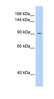 Western Blot: OSMR beta Antibody [NBP1-62543]