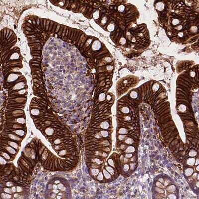 Immunohistochemistry-Paraffin: OSTB Antibody [NBP1-91108]