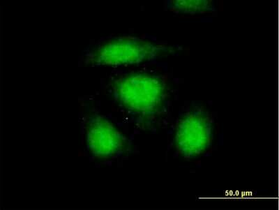 Immunocytochemistry/ Immunofluorescence: OSTF1 Antibody [H00026578-B02P]