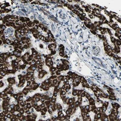 Immunohistochemistry-Paraffin: OSTM1 Antibody [NBP1-81829]