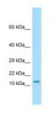 Western Blot: OTOS Antibody [NBP1-98417]