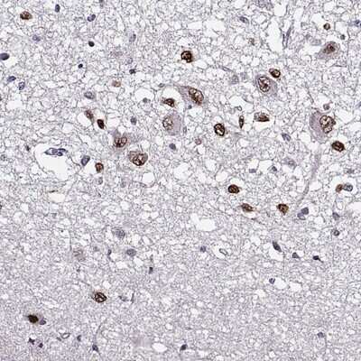 Immunohistochemistry-Paraffin: OTP Antibody [NBP2-68751]
