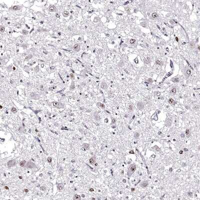 Immunohistochemistry-Paraffin: OTP Antibody [NBP2-68751]
