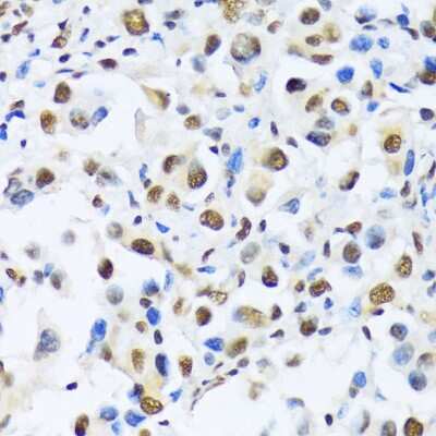 Immunohistochemistry-Paraffin: OTP Antibody - Azide and BSA Free [NBP2-94084]