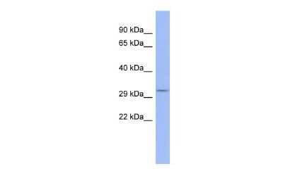 Western Blot: OTP Antibody [NBP2-87994]
