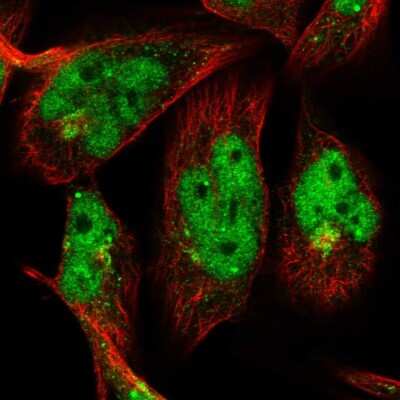 Immunocytochemistry/ Immunofluorescence: OTUD1 Antibody [NBP2-58371]