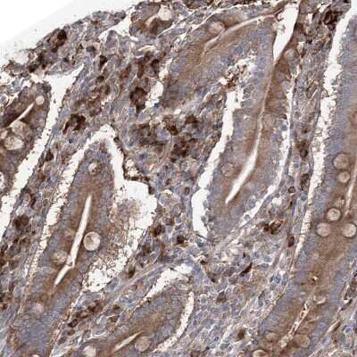 Immunohistochemistry-Paraffin: OTUD1 Antibody [NBP1-90484]