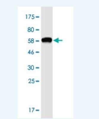 Western Blot: OTUD6B Antibody (3H4) [H00051633-M04-100ug]