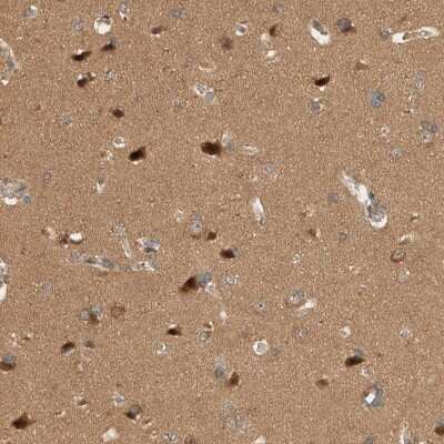 Immunohistochemistry-Paraffin: OTUD6B Antibody [NBP1-85651]
