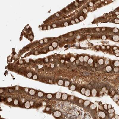 Immunohistochemistry-Paraffin: OTUD6B Antibody [NBP1-85652]