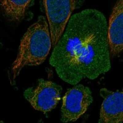 Immunocytochemistry/ Immunofluorescence: OTUD7B/Cezanne/ZA20D1 Antibody [NBP3-17748]