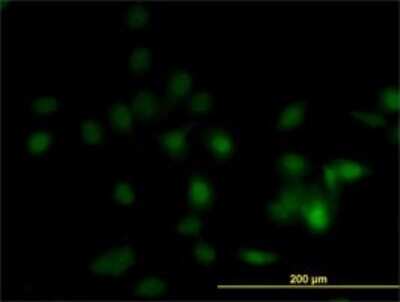 Immunocytochemistry/ Immunofluorescence: OVCA1 Antibody (2C5) [H00001801-M02]