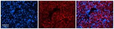 Immunohistochemistry: OVCA1 Antibody [NBP1-57711]
