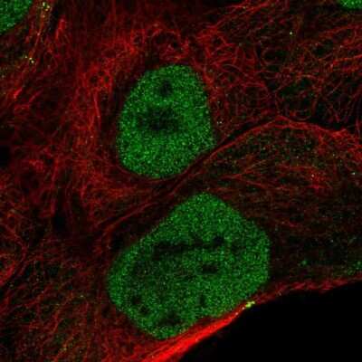 Immunocytochemistry/ Immunofluorescence: OVCA2 Antibody [NBP2-56767]
