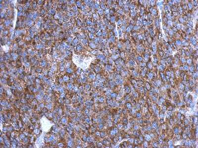 Immunohistochemistry-Paraffin: OVCA2 Antibody [NBP2-15058]