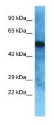 Western Blot: OVCH2 Antibody [NBP3-09872]