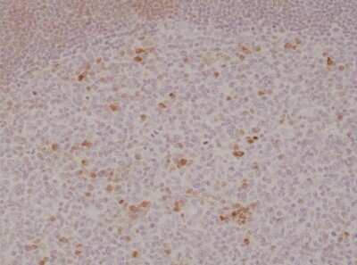 Immunohistochemistry-Paraffin: OX40/TNFRSF4 Antibody (RM313) [NBP2-61570]