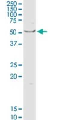 Western Blot: OXCT1 Antibody [H00005019-D01P]