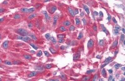 Immunohistochemistry-Paraffin: OXGR1/GPR80/P2Y15 Antibody - BSA Free [NLS6747]