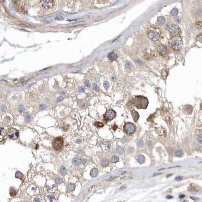 Immunohistochemistry-Paraffin: OXR1 Antibody [NBP1-86391]
