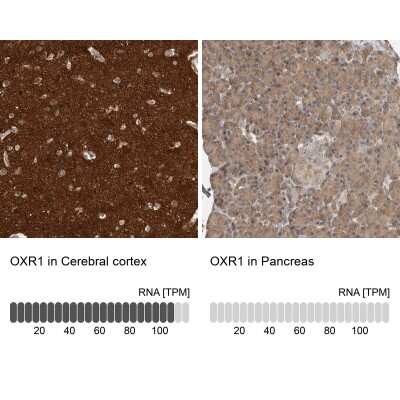 Immunohistochemistry-Paraffin: OXR1 Antibody [NBP1-86392]