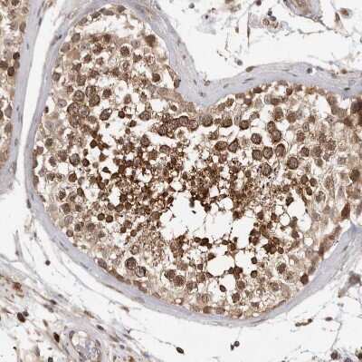 Immunohistochemistry-Paraffin: OXR1 Antibody [NBP1-86392]
