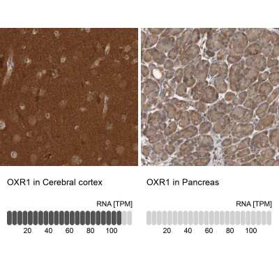 Immunohistochemistry-Paraffin: OXR1 Antibody [NBP1-86393]