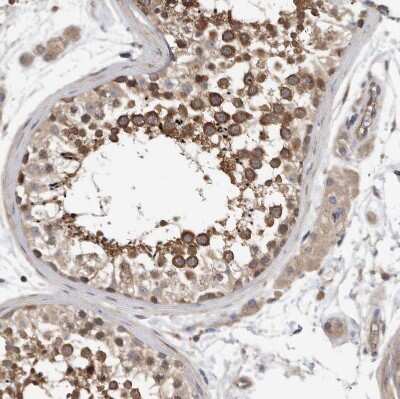Immunohistochemistry-Paraffin: OXR1 Antibody [NBP1-86393]