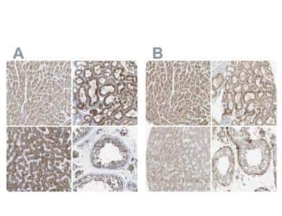 Immunohistochemistry-Paraffin: OXSM Antibody [NBP1-84730]