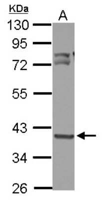 Western Blot: OXSM Antibody [NBP2-19647]
