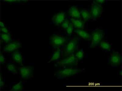 Immunocytochemistry/ Immunofluorescence: OXSR1 Antibody (1B9) [H00009943-M19]