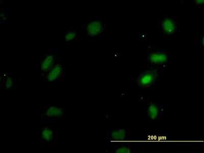 Immunocytochemistry/ Immunofluorescence: OXSR1 Antibody (3A8) [H00009943-M16]