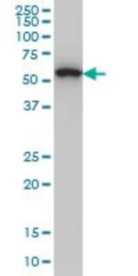 Western Blot: OXSR1 Antibody (3A8) [H00009943-M16]