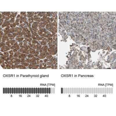 Immunohistochemistry-Paraffin: OXSR1 Antibody [NBP1-82929]