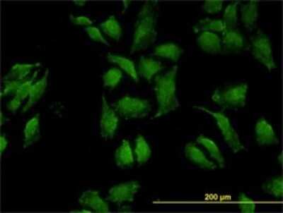 Immunocytochemistry/ Immunofluorescence: Occludin Antibody (1G7) [H00004950-M01]