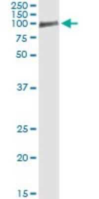 Immunoprecipitation: Occludin Antibody (1G7) [H00004950-M01]