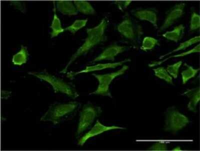 Immunocytochemistry/ Immunofluorescence: Occludin Antibody (5A7) [H00004950-M02]