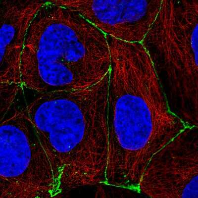 Immunocytochemistry/ Immunofluorescence: Occludin Antibody (CL1567) [NBP2-52972]