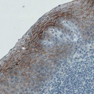 Immunohistochemistry-Paraffin: Occludin Antibody (CL1608) [NBP2-52973]