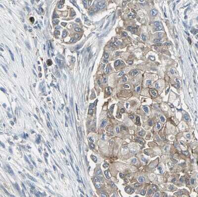 Immunohistochemistry-Paraffin: Occludin Antibody [NBP1-87402]