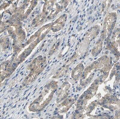 Immunohistochemistry-Paraffin: Occludin Antibody [NBP1-87402]