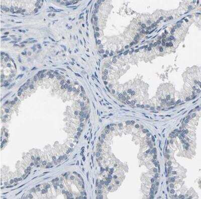 Immunohistochemistry-Paraffin: Occludin Antibody [NBP1-87402]