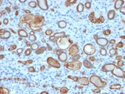 Immunohistochemistry-Paraffin: Occludin Antibody (OCLN/2181) [NBP3-07137]