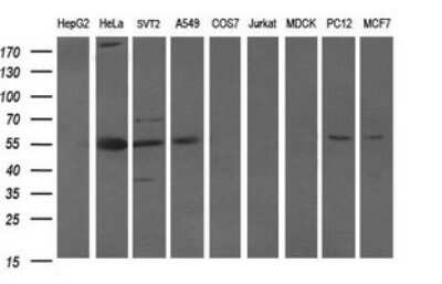 Western Blot: Oct-4B Antibody (OTI7H1) [NBP2-45376]